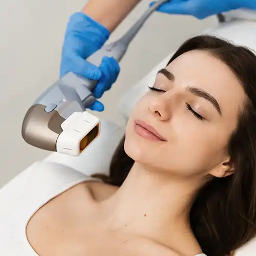 Aplicação de Ultraformer no pescoço de uma paciente