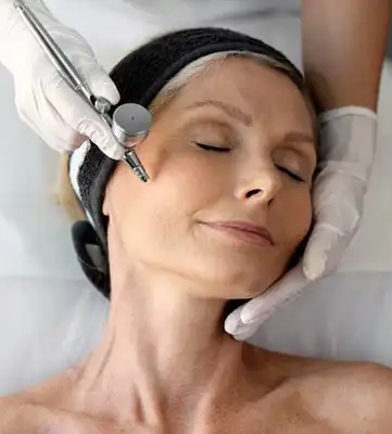 Bioestimuladores de Colágeno