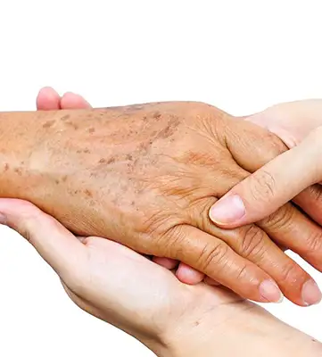 Clareamento de Melanoses Solares com Luz Pulsada ou Crioterapia