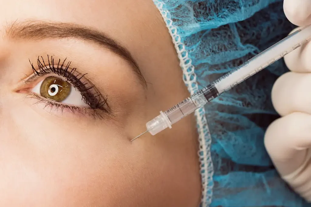 Primeiro botox: as 5 dúvidas que todo mundo tem antes de fazer